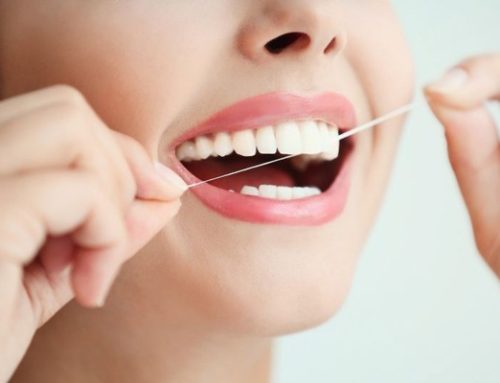 How Diet Affects Your Teeth Whitening Results | Cosmetic Dentist in Medina