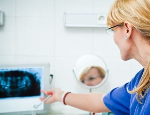 Small Changes, Big Results: Micro-Aesthetics in Cosmetic Dentistry | Cosmetic Dentist in Medina